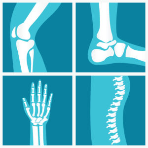 Joint, Hand, and Spine Pain | AICA Jonesboro
