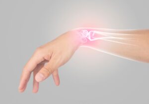 Carpal Tunnel vs. Tendonitis Symptoms and Differences