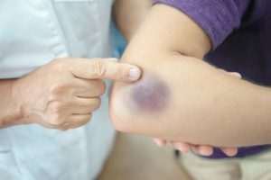 11-of-the-Most-Common-Car-Accident-Injuries